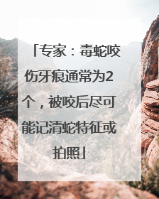 专家：毒蛇咬伤牙痕通常为2个，被咬后尽可能记清蛇特征或拍照